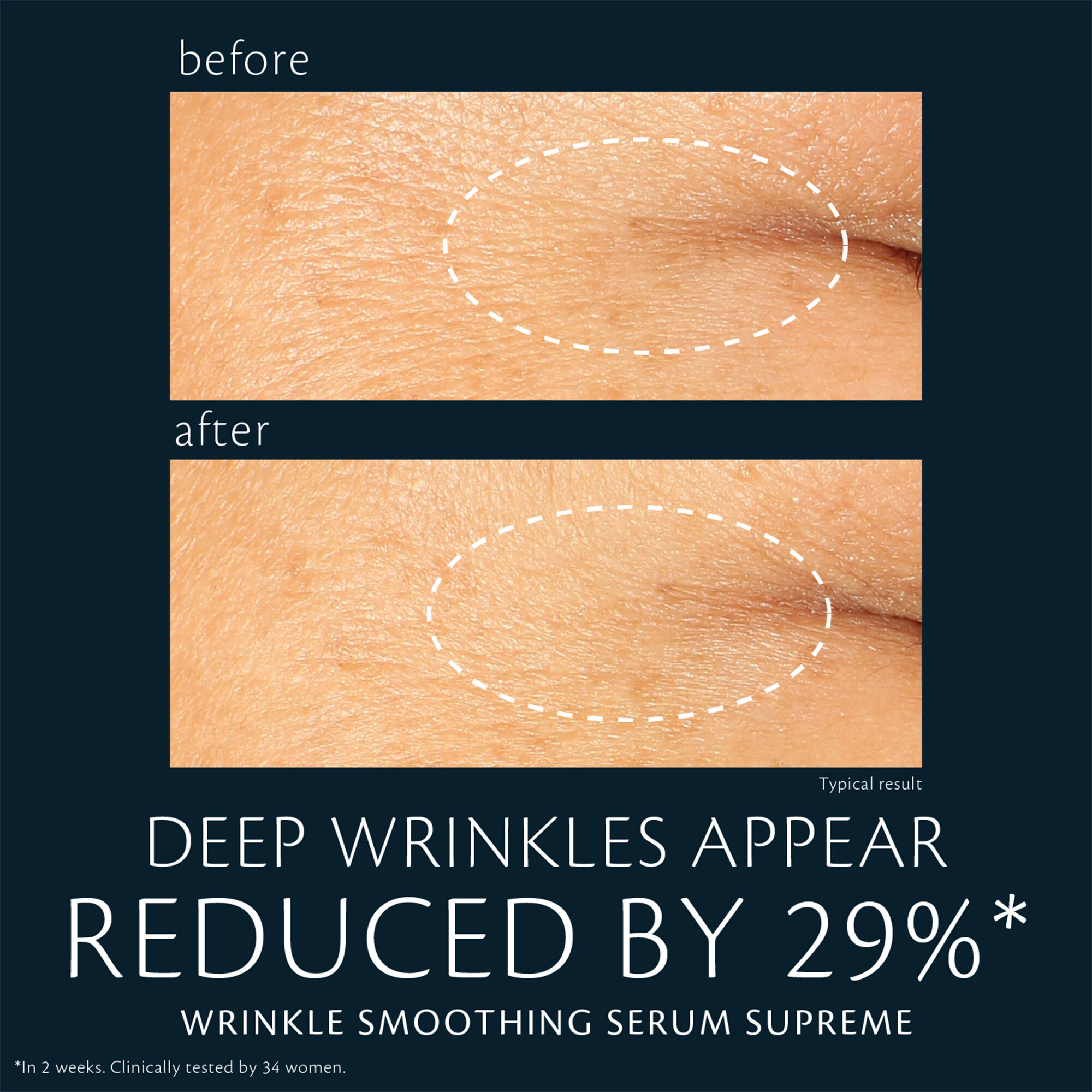 Wrinkle Smoothing Retinol Serum Supreme | Clé de Peau Beauté